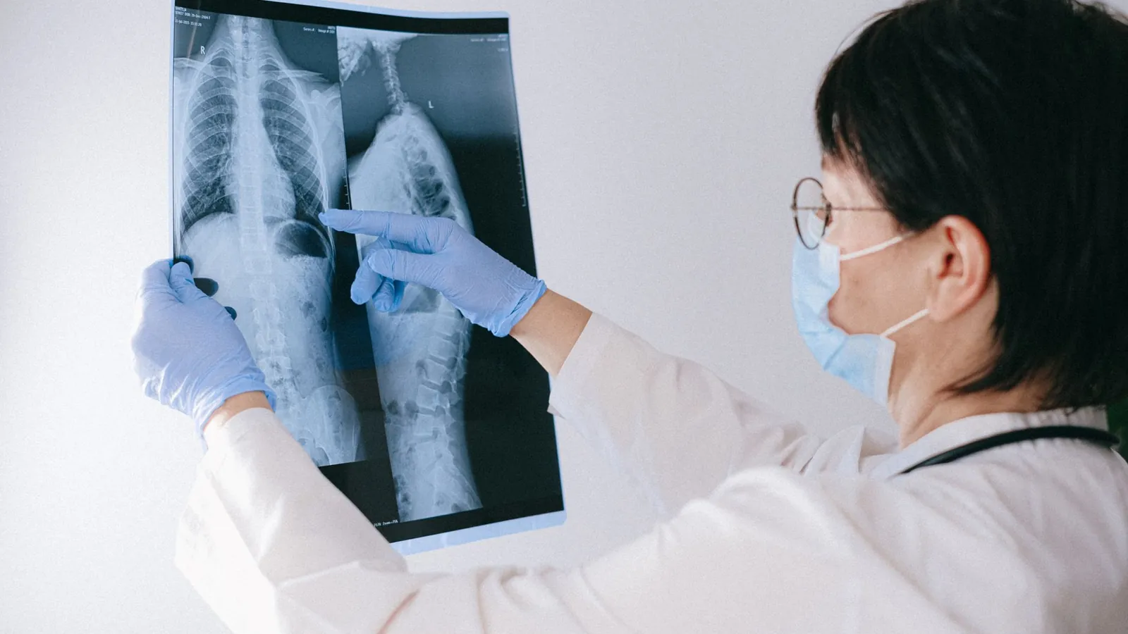 A clinician pointing at an X ray film
